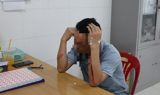 Điều dưỡng bị người nhà bệnh nhân hành hung ở Bình Phước. Ảnh: Dương Bình