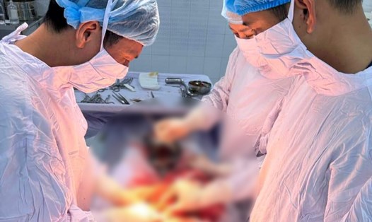 Ảnh: Kíp mổ do các bác sĩ Khoa sản - Bệnh viện Đa khoa Nam Tiền Hải thực hiện trong khoảng 40 phút đã kịp thời cứu sống thai phụ 24 tuổi. Ảnh: Bệnh viện cung cấp