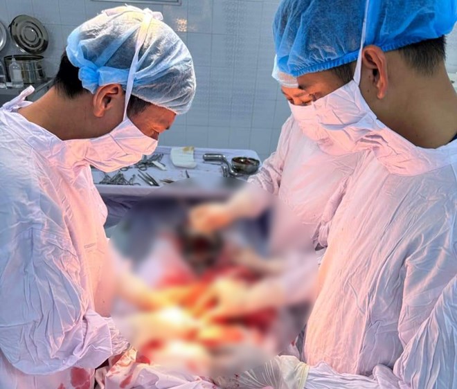 Kịp thời cứu sống thai phụ ở Thái Bình mang thai ngoài tử cung bị vỡ