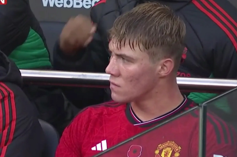 Ánh mắt đượm buồn của Hojlund sau khi bị thay ra nghỉ trong trận đấu với Fulham. (Ảnh cắt từ video)