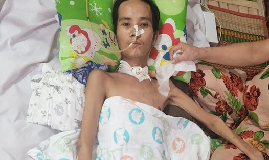 Anh Trần Đăng Khoa (SN 1991, ở thị xã Duyên Hải, tỉnh Trà Vinh), bị tai nạn giao thông, không tiền chữa trị phải nằm liệt tại nhà, sống nương nhờ tình thương của các nhà hảo tâm. Ảnh: Hoàng Lộc