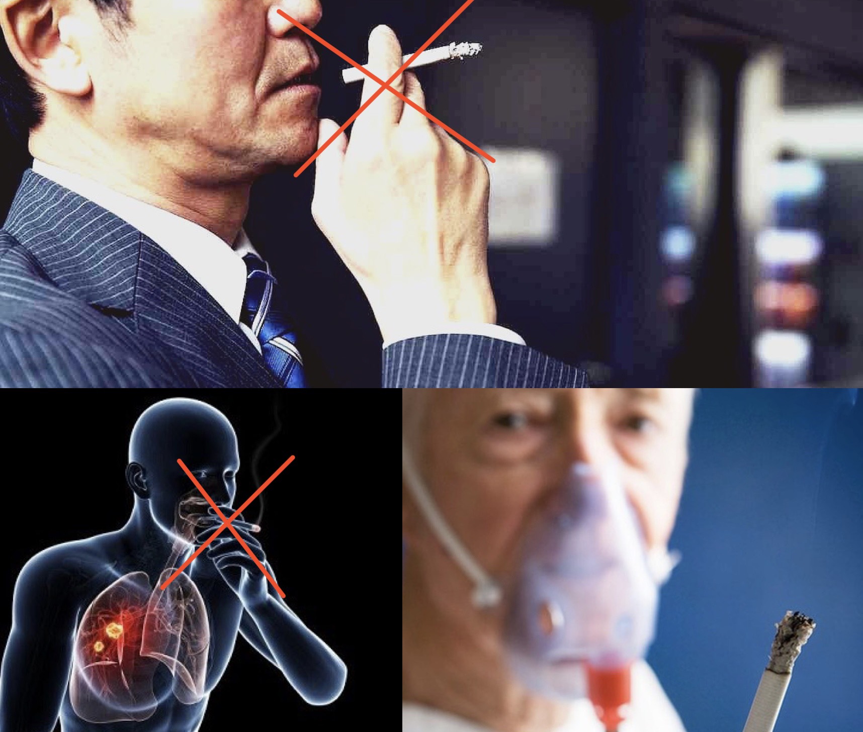 Hút thuốc lá là nguyên nhân chính gây ra căn bệnh ung thư phổi. Đồ họa: Hương Giang