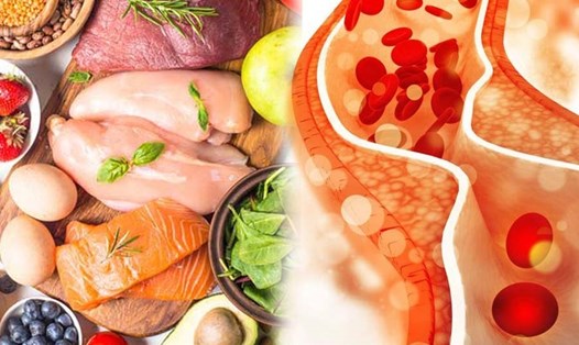 Một số thực phẩm được nhiều người lựa chọn tiêu thụ vào mùa đông nhưng lại có thể làm tăng lượng cholesterol, ảnh hưởng đến sức khỏe tổng thể. Ảnh: Hạ Mây
