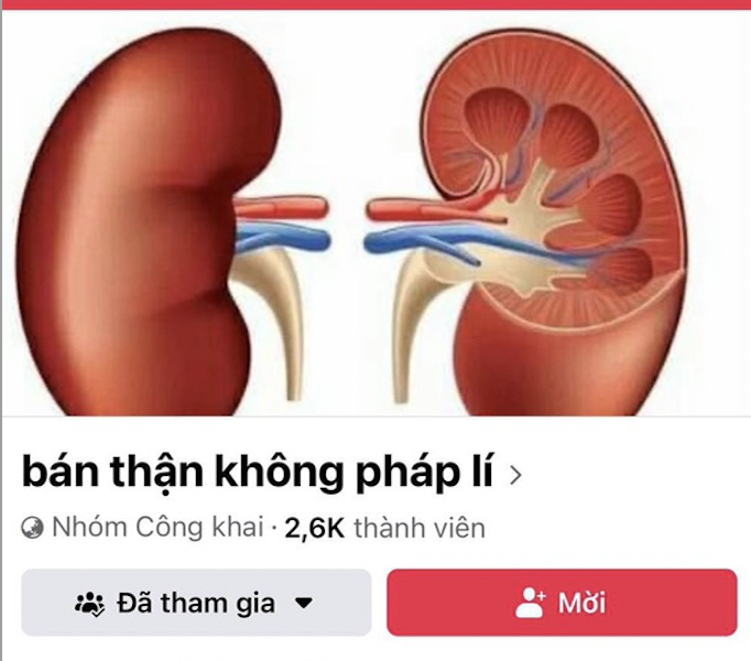 Đủ chiêu trò trục lợi ở các hội nhóm mua bán thận