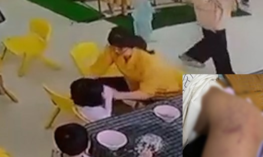 Làm rõ vụ bé gái 3 tuổi ở Bình Định bị cô giáo bạo hành. Ảnh chụp màn hình