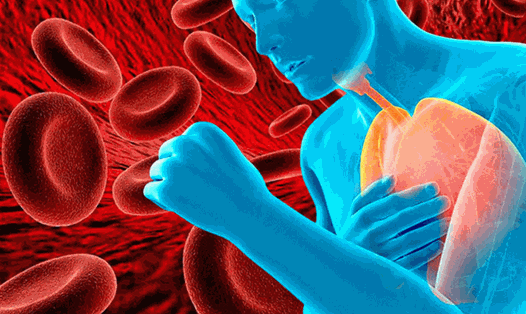Thiếu sắt dẫn đến giảm nồng độ hemoglobin trong máu và thường được gọi là thiếu máu do thiếu sắt. Ảnh: Thiện Nhân