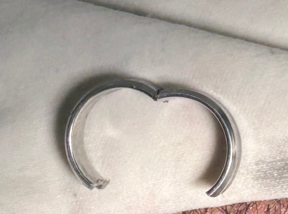 Vòng nhẫn được lấy ra khỏi dương vật bệnh nhân. Ảnh: BVCC