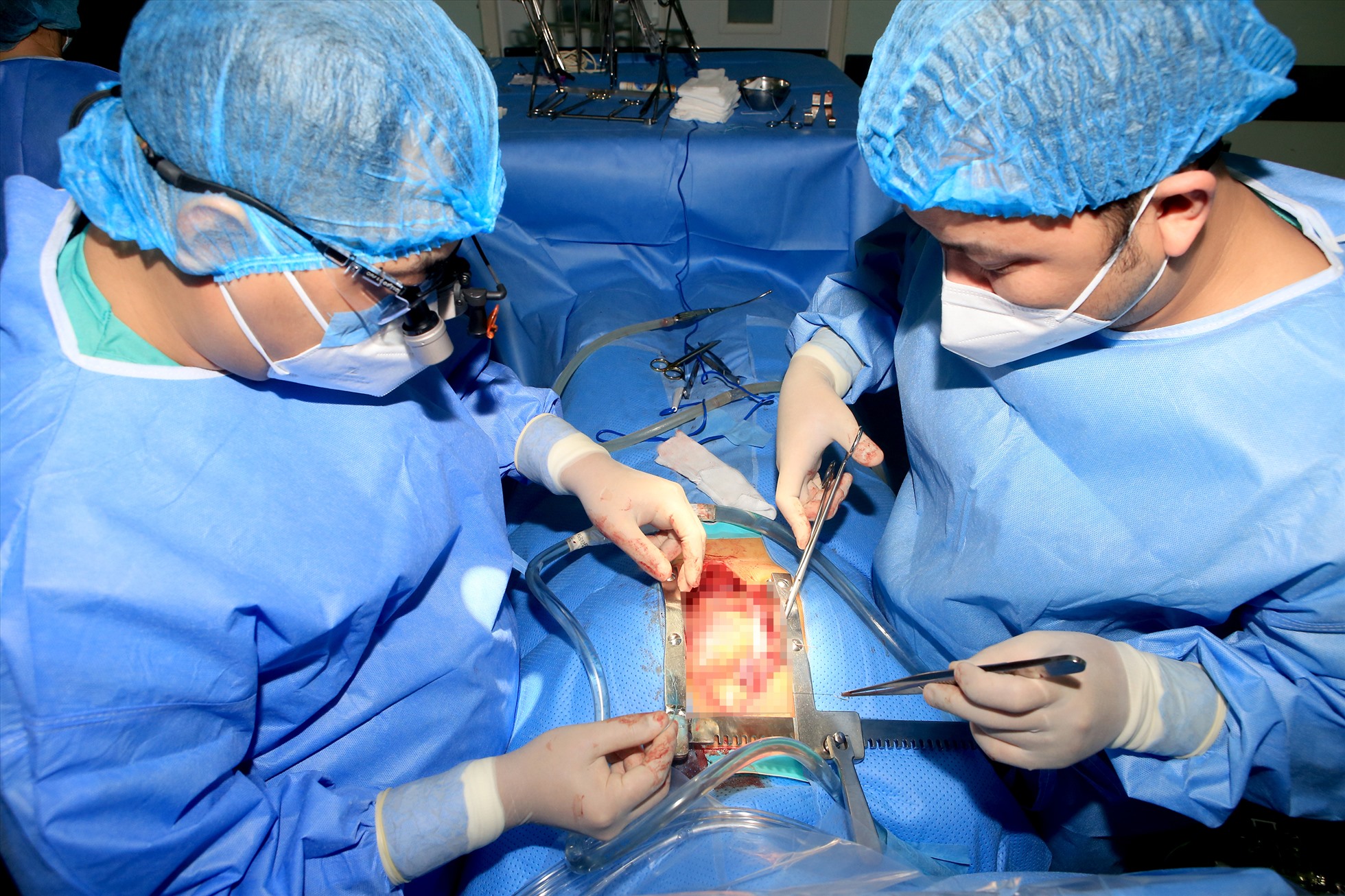 Một ca ghép thận tại Bệnh viện Trung ương Huế. Ảnh: Thương Hiển