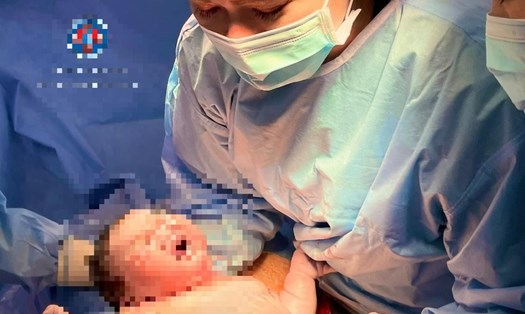 Em bé nặng 5,8kg chào đời an toàn. Ảnh: Bệnh viện Hùng Vương TPHCM