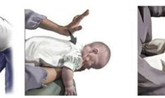 Sơ cứu cho bé khi bị sặc sữa. Nguồn ảnh: Bệnh viện Nhi Trung ương