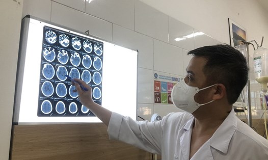Bác sĩ Nguyễn Trung Nguyên đánh giá mức độ tổn thương não của bệnh nhân ngộ độc cồn công nghiệp methanol.Ảnh: Bệnh viện cung cấp