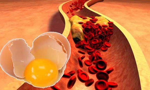 Lòng đỏ trứng không gây ra các bệnh như mỡ máu cao. Đồ hoạ: Hạ Mây