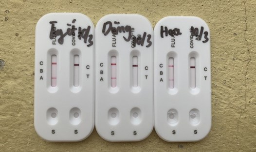 3 trường hợp test nhanh dương tính với cúm A. Nguồn ảnh: Sở Y tế Lào Cai