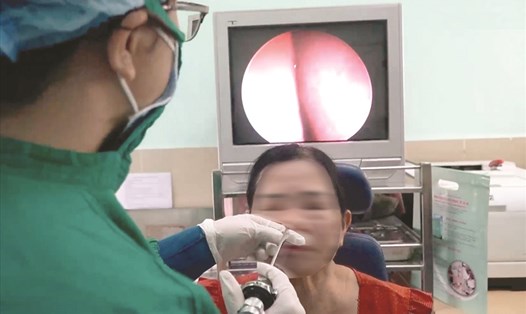 Bệnh nhân nội soi mũi. Ảnh: Nguyễn Ly
