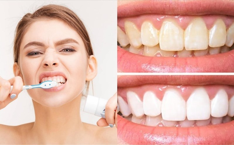 Vì sao người Việt thường gặp nhiều vấn đề răng miệng?