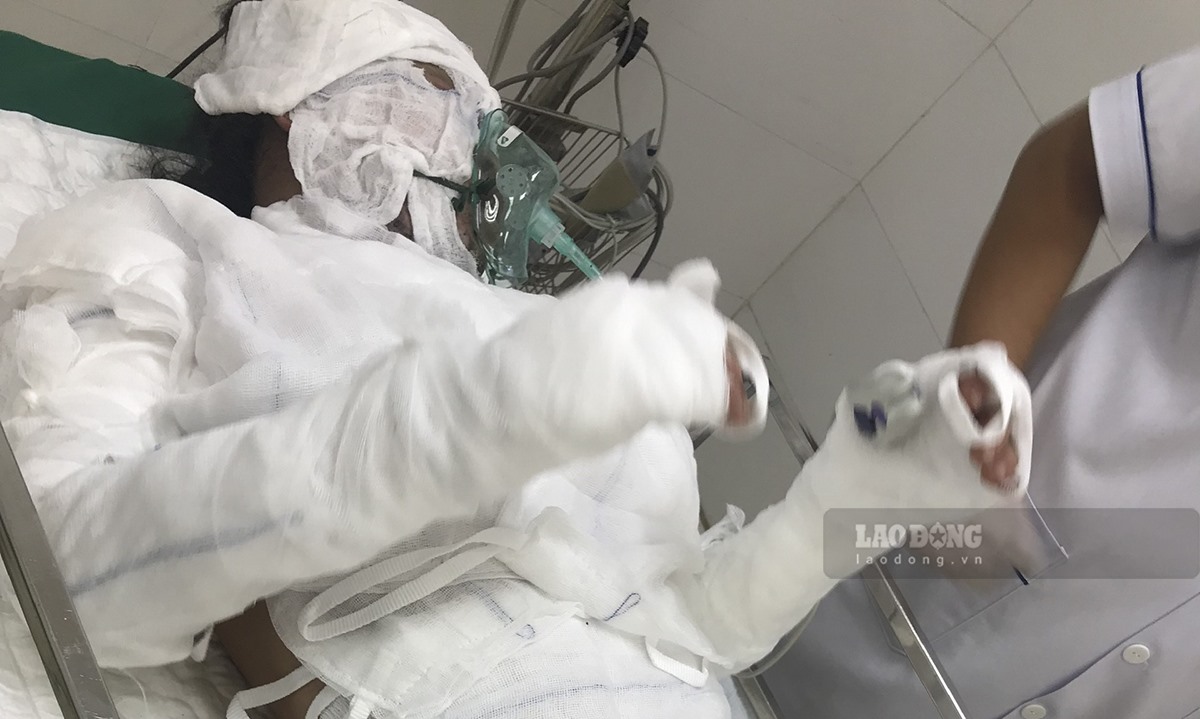 Vụ cháy xe cứu thương "0 đồng" tại Điện Biên khiến 1 sản phụ câm điếc bị bỏng nặng. Ảnh: Văn Thành Chương