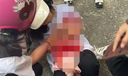 Nhóm 11 nữ sinh đánh nhau khiến 2 bạn thương tích phải nhập viện. Ảnh: Người dân cung cấp