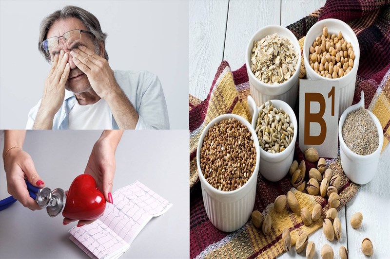 Thiếu vitamin B1 và bệnh beriberi có liên quan nhau không?
