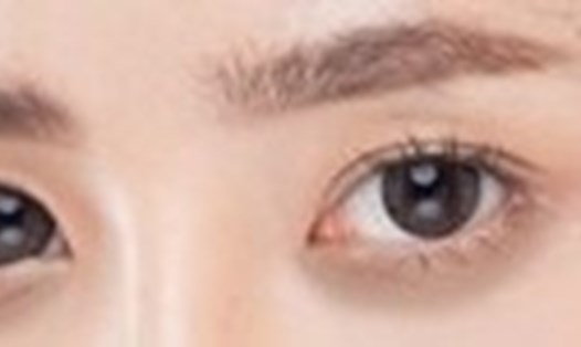 Quầng thâm mắt được giảm nhờ một số phương pháp làm tại nhà. Ảnh: Hoàng Anh