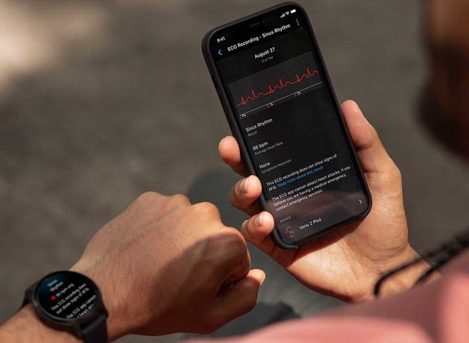 Ứng dụng điện tâm đồ ECG trên Garmin Venu 2 Plus sẽ khả dụng tại Việt Nam từ tháng 4.2023. Ảnh: Garmin