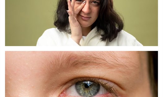 Mắt là vùng nhạy cảm trên gương mặt, nếu dùng mỹ phẩm sai cách bạn có thể khiến đôi mắt bị ảnh hưởng. Đồ họa: Thu Trang