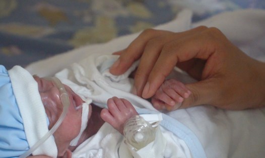 Bé trai sinh non khi 29 tuần tuổi, nặng 600g. Ảnh: Bệnh viện Đa khoa Hùng Vương