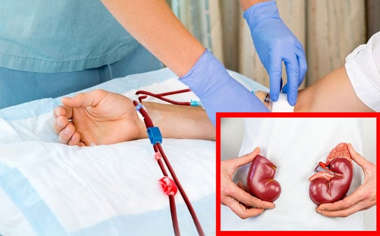 Những thói quen hằng ngày giúp thận khỏe mạnh hơn