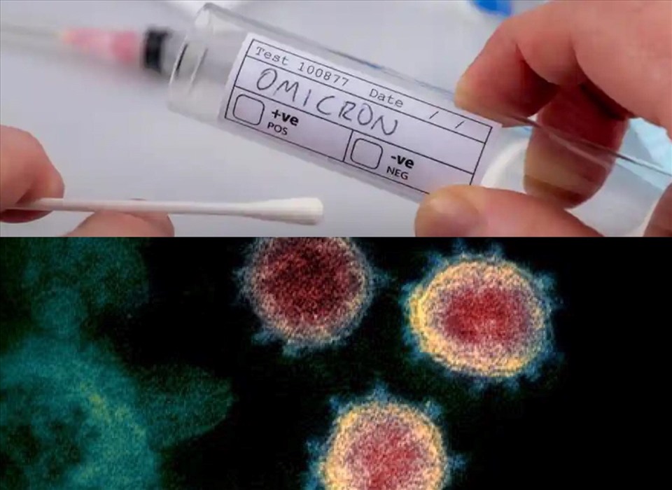 Giải trình tự gen trên các bệnh nhân COVID-19 xác định biến chủng gây bệnh. Ảnh: Hương Giang