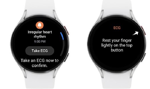 Những chiếc Galaxy Watch nói riêng hay thị trường đồng hồ thông minh nói chung đều đang nhắm tới những tính năng theo dõi sức khoẻ con người. Ảnh: Samsung