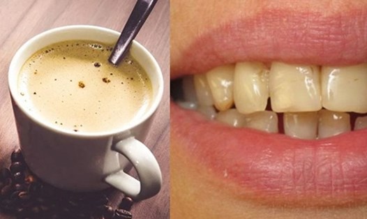 Cà phê có thể khiến răng ố vàng. Đồ họa: Việt Anh