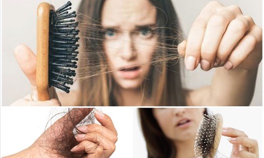 Một trong những nguyên nhân gây rụng tóc phổ biến nhất xoay quanh chế độ dinh dưỡng của bạn. Đồ hoạ: Minh Thư