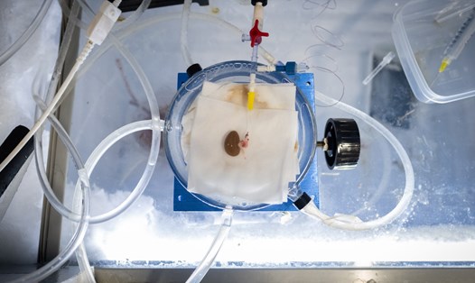 Thận chuột chuẩn bị cấy ghép trong nghiên cứu của Đại học Minnesota về kỹ thuật mới bảo quản đông lạnh nội tạng thời gian dài. Ảnh: Stat