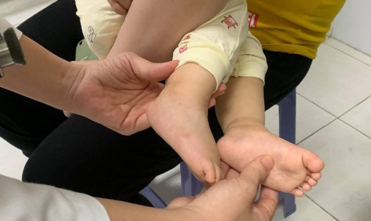 Chủ động phòng, chống bệnh chân tay miệng ở trẻ em. Ảnh: Nguyễn Trường