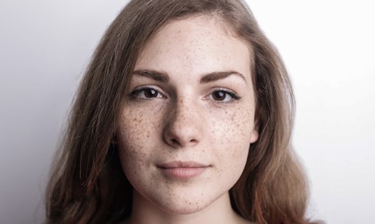Các chị em có thể tham khảo những phương pháp tự nhiên để chăm sóc làn da, loại bỏ tàn nhang hiệu quả. Ảnh: Pixabay