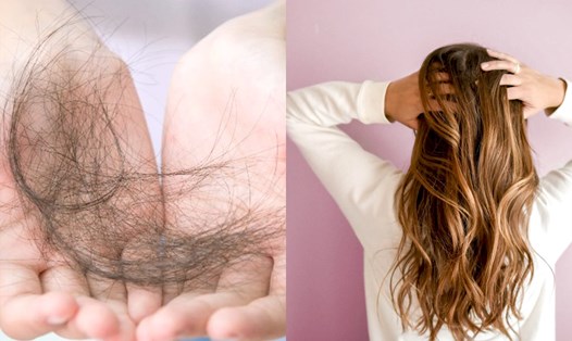 7 lý do khiến tóc của bạn rụng nhiều. Đồ họa: Minh Nhật