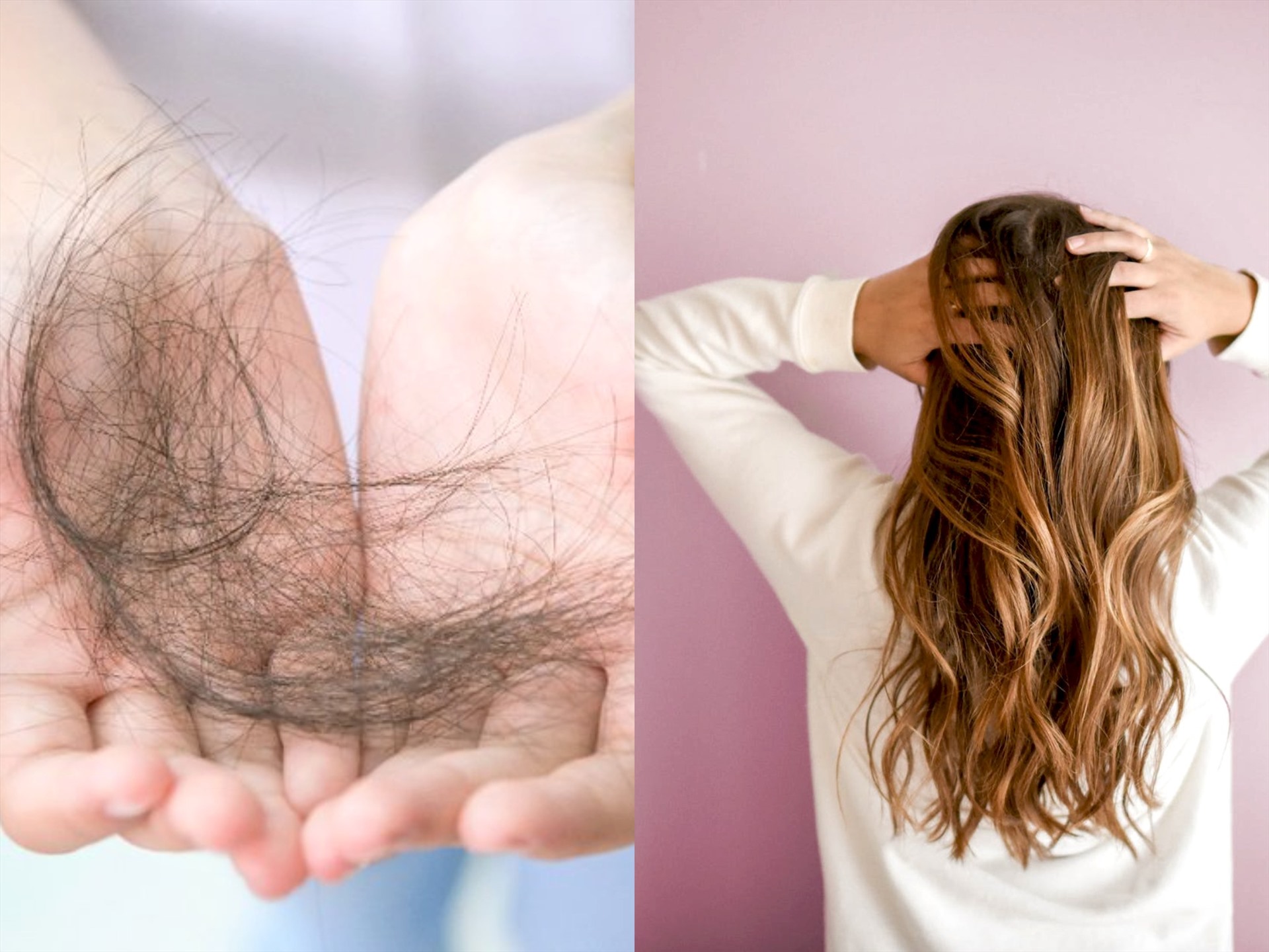Rụng tóc nhiều là bệnh gì? Cách khắc phục rụng tóc ở nữ và nam