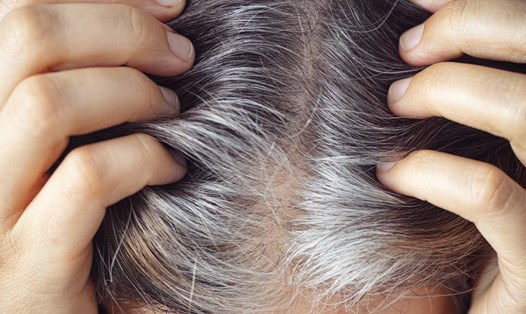 Có nhiều nguyên nhân khiến tóc bạc sớm, có thể do gene di truyền hoặc lạm dụng các sản phẩm chăm sóc. Ảnh: Pixabay