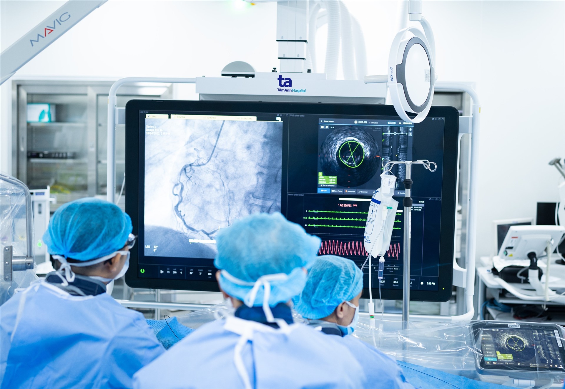 Ứng dụng công nghệ hiện đại chụp mạch vành và đặt stent tim mạch tối thiểu thuốc cản quang, giảm tái hẹp. Ảnh: Bệnh viện Tâm Anh.