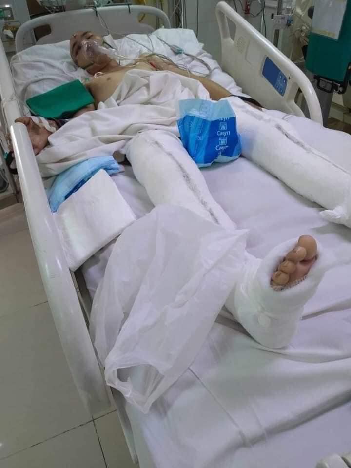 Em Nguyễn Văn Công đang điều trị tại Bệnh Việt Đức (Hà Nội). Ảnh: Gia đình cung cấp