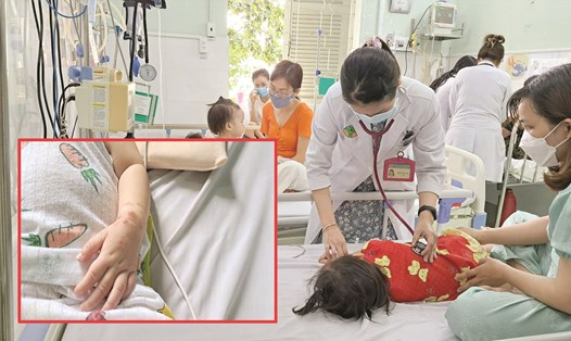 Nhiều trẻ tại TP Hồ Chí Minh bị mắc bệnh tay chân miệng. Ảnh: Hạ Mây