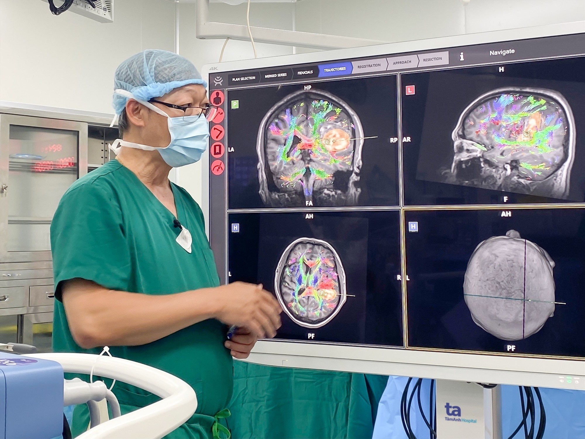 Robot AI hòa hình MRI, DTI.. cho thấy rõ các bó sợi thần kinh và khối máu tụ chèn ép trong não người bệnh. Ảnh: Nguyễn Trăm.