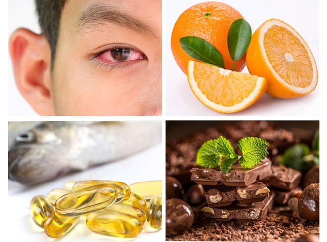 5 thực phẩm tăng cường sức khỏe cho mắt trong các đợt gió mùa