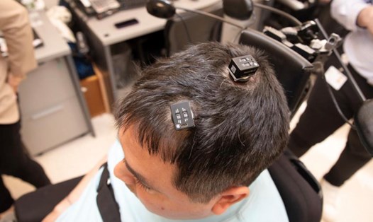 Các cổng kết nối được lắp trên đầu để bệnh nhân kết nối với máy tính. Ảnh: Viện Nghiên cứu Y học Feinstein của Northwell Health