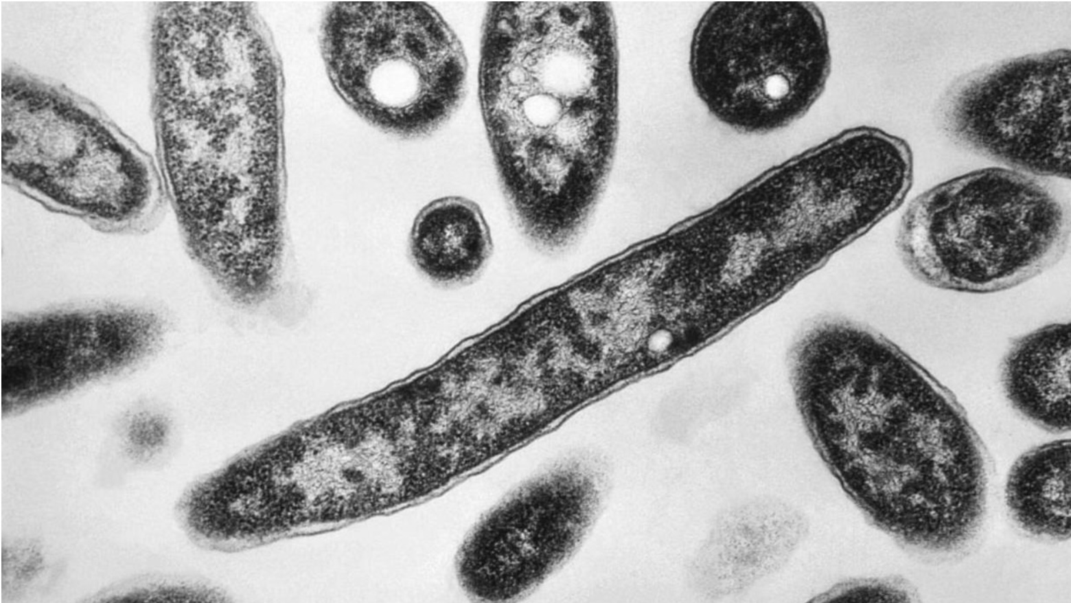 Vi khuẩn gây bệnh Legionnaires. Ảnh: CDC Mỹ