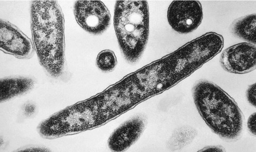 Vi khuẩn gây bệnh Legionnaires. Ảnh: CDC Mỹ