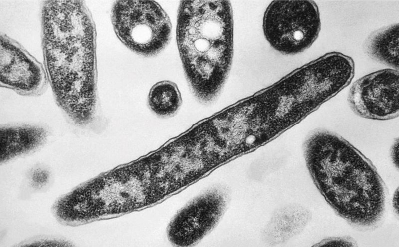 Vi khuẩn gây bệnh Legionnaires. Ảnh: CDC Mỹ