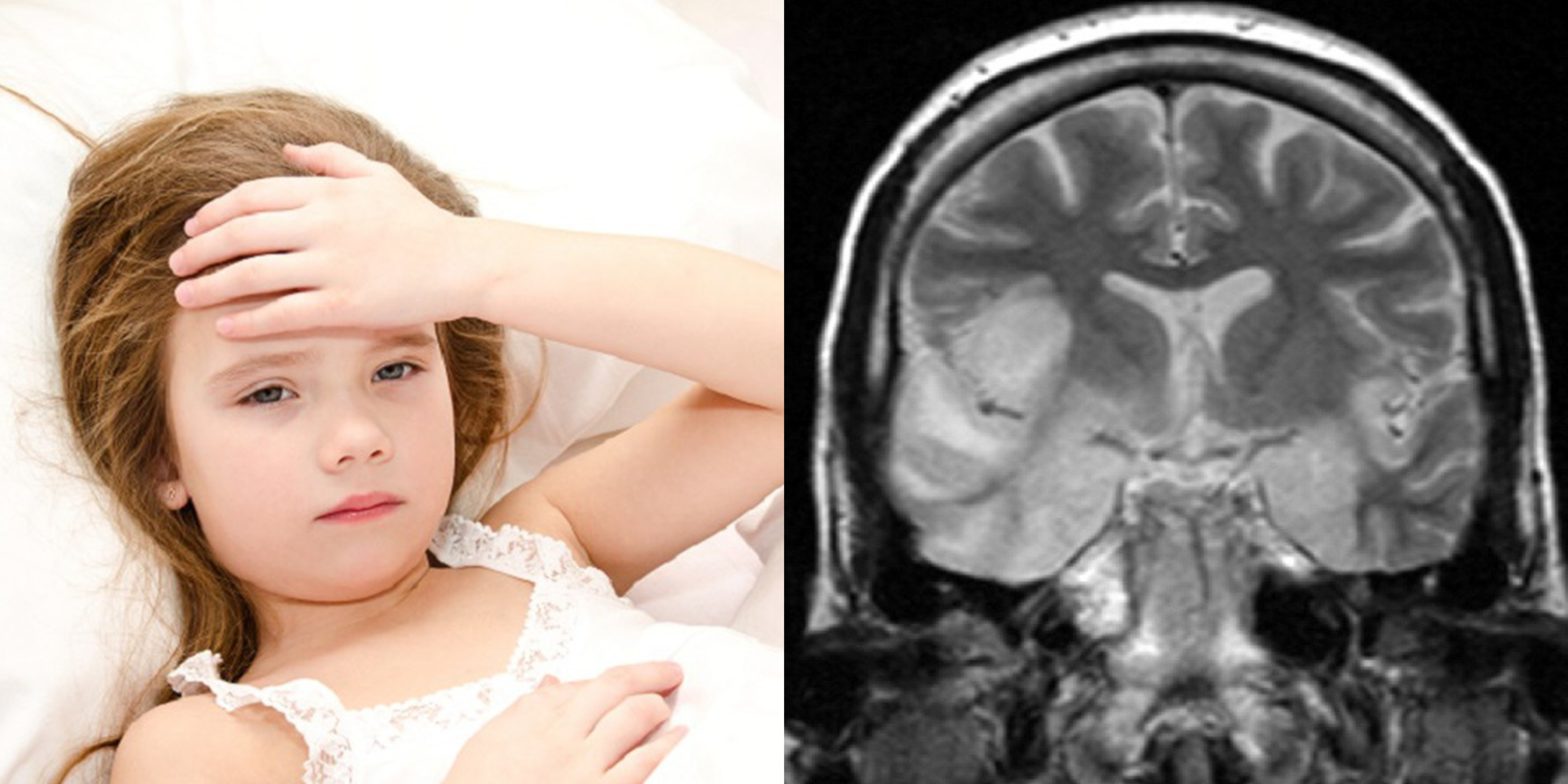 Chỉ sau 3 ngày sốt cao cùng co giật, bệnh nhi 7 tuổi phát hiện căn bệnh viêm màng não. Ảnh: Phương Linh