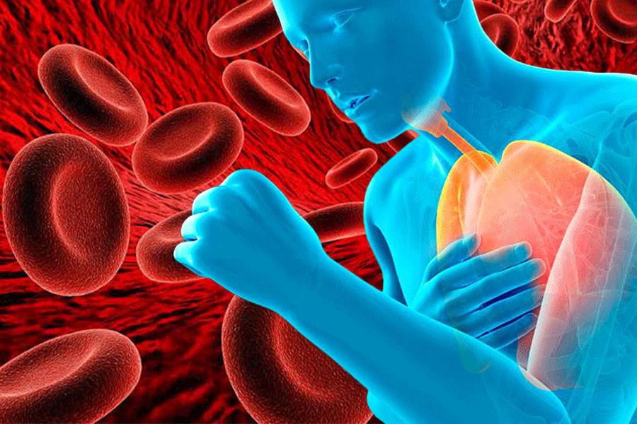 Thiếu máu xảy ra khi máu của bạn bị giảm số lượng tế bào hồng cầu, gây khó khăn cho việc vận chuyển oxy từ phổi đến các phần còn lại của cơ thể. Đồ họa: Thiện Nhân