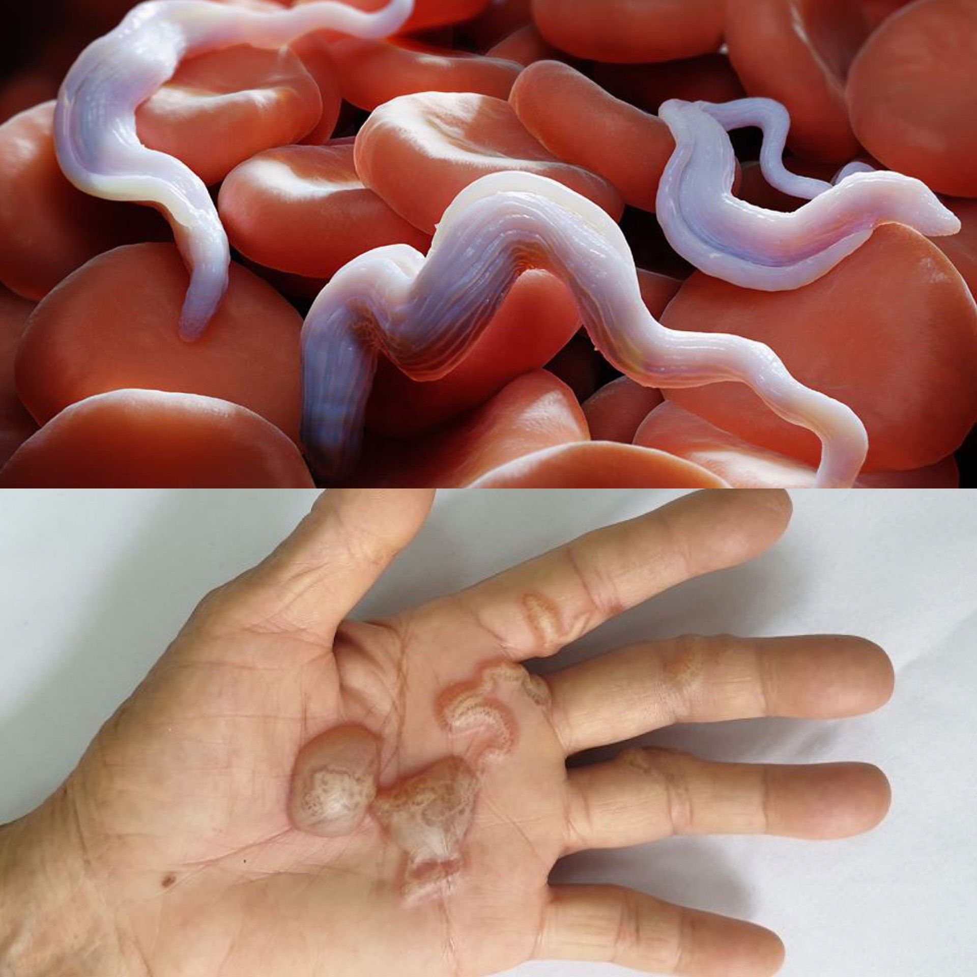 Đặc biệt quan tâm đối với các bệnh do ký sinh trùng. Đồ họa: Hương Giang