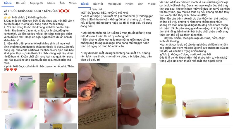 Nhiều bài viết được chia sẻ trên mạng xã hội khuyến cáo người dùng không nên tùy tiện sử dụng thuốc nhỏ mắt chứa corticoid khi chưa có sự chỉ định của bác sĩ. Ảnh: Chụp màn hình.